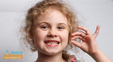 پوسیدگی دندان کودکان,درمان پوسیدگی دندان کودکان,دلیل پوسیدگی دندان کودکان